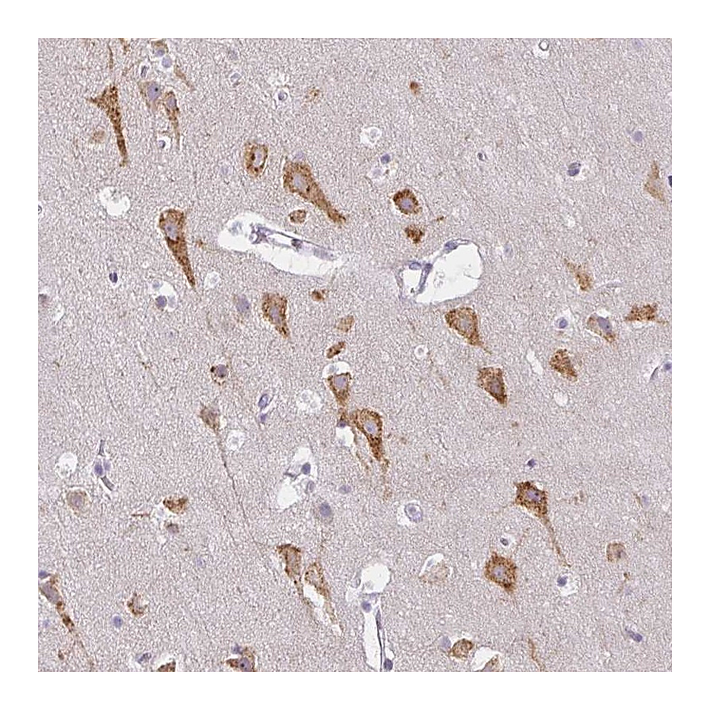 Atlas Antibodies Anti-ZFYVE26 Antibody