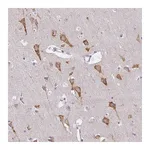 Atlas Antibodies Anti-ZFYVE26 Antibody