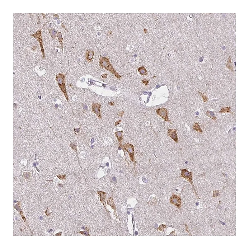 Atlas Antibodies Anti-ZFYVE26 Antibody