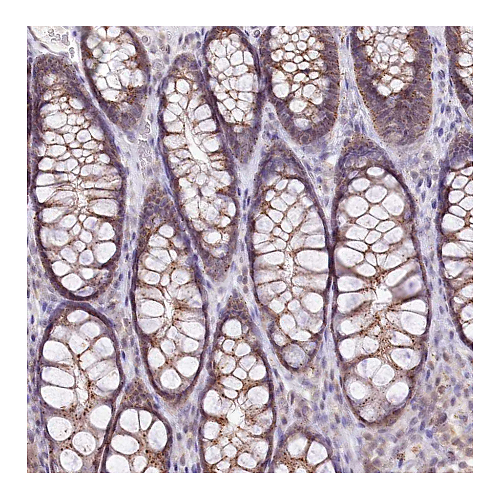 Atlas Antibodies Anti-ZFYVE27 Antibody