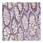 Atlas Antibodies Anti-ZFYVE27 Antibody