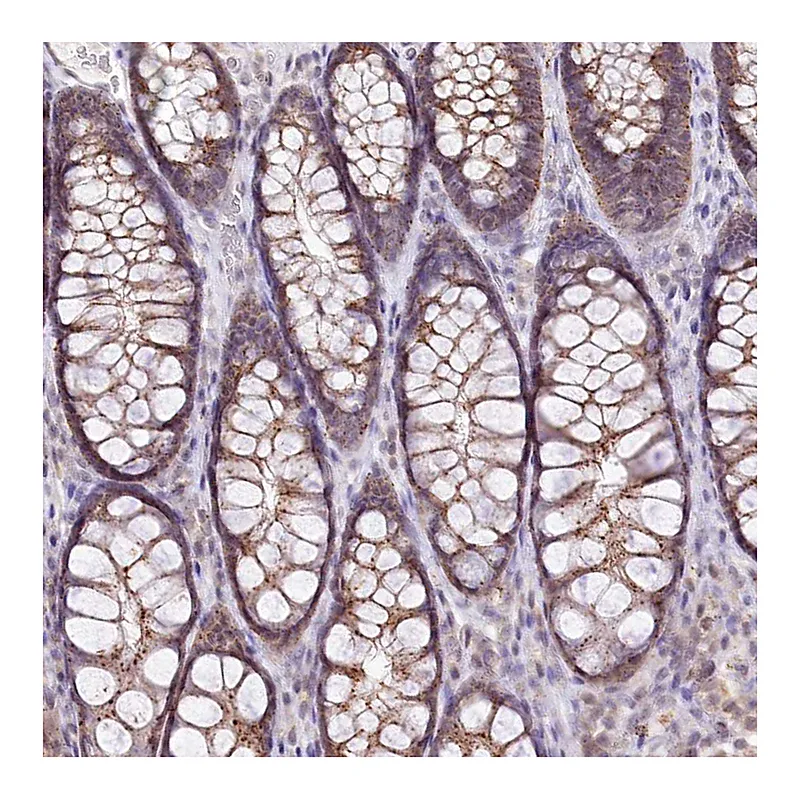 Atlas Antibodies Anti-ZFYVE27 Antibody