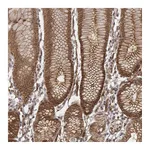 Atlas Antibodies Anti-ZFYVE19 Antibody