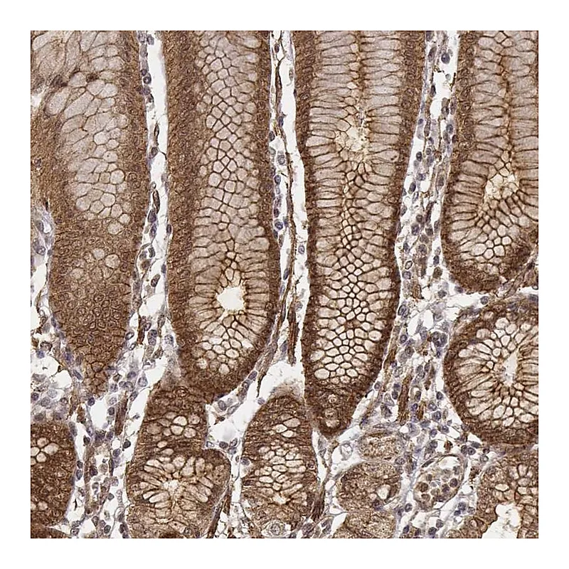Atlas Antibodies Anti-ZFYVE19 Antibody