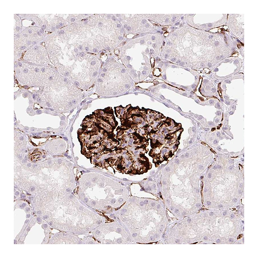 Atlas Antibodies Anti-ZFYVE21 Antibody