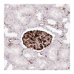 Atlas Antibodies Anti-ZFYVE21 Antibody