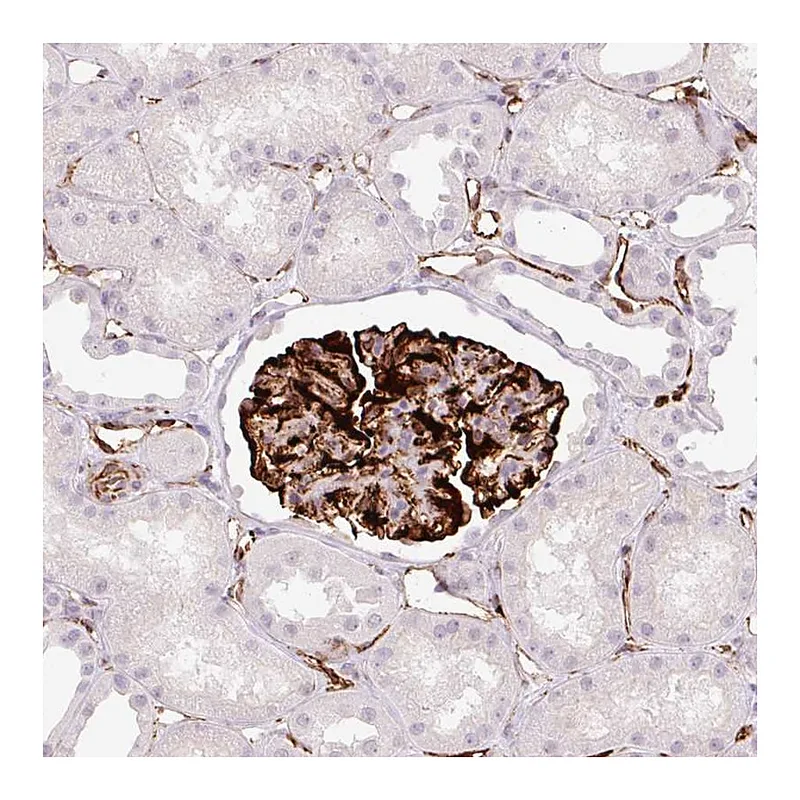 Atlas Antibodies Anti-ZFYVE21 Antibody