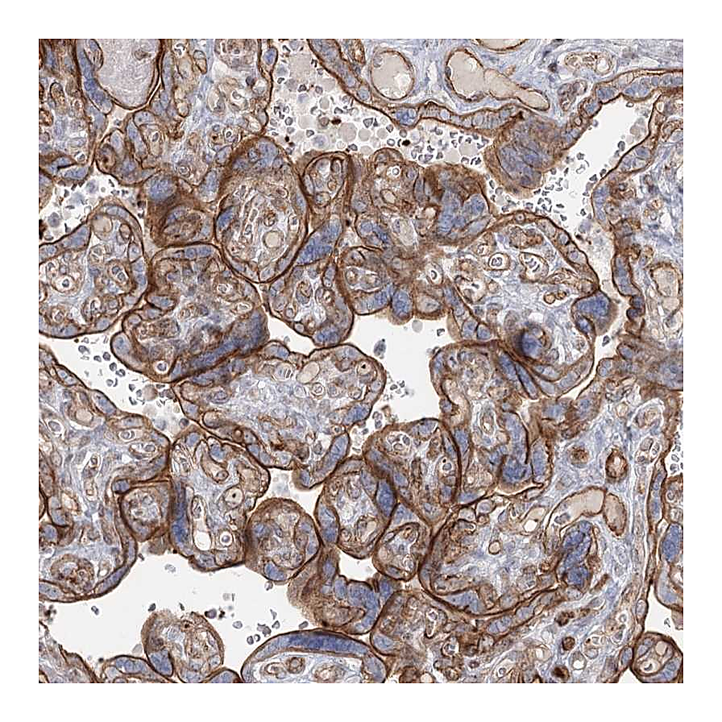 Atlas Antibodies Anti-ZFYVE28 Antibody