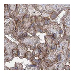 Atlas Antibodies Anti-ZFYVE28 Antibody