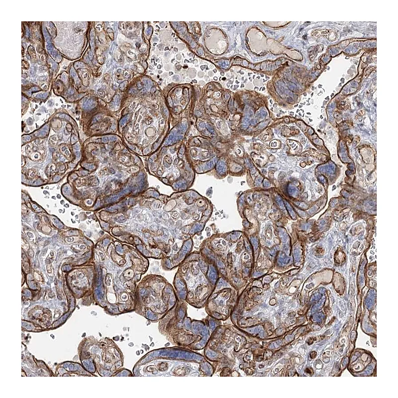 Atlas Antibodies Anti-ZFYVE28 Antibody