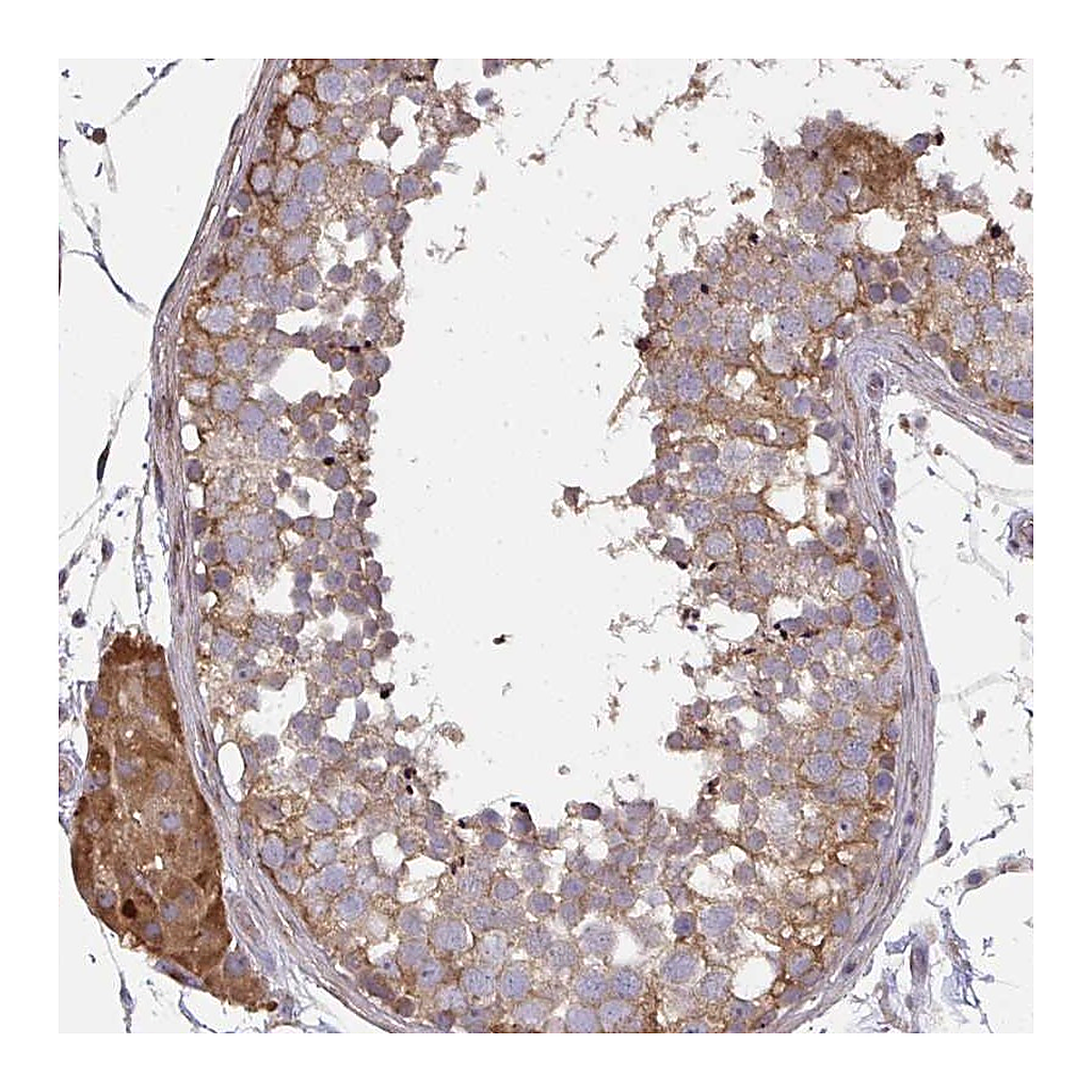 Atlas Antibodies Anti-ZFYVE28 Antibody
