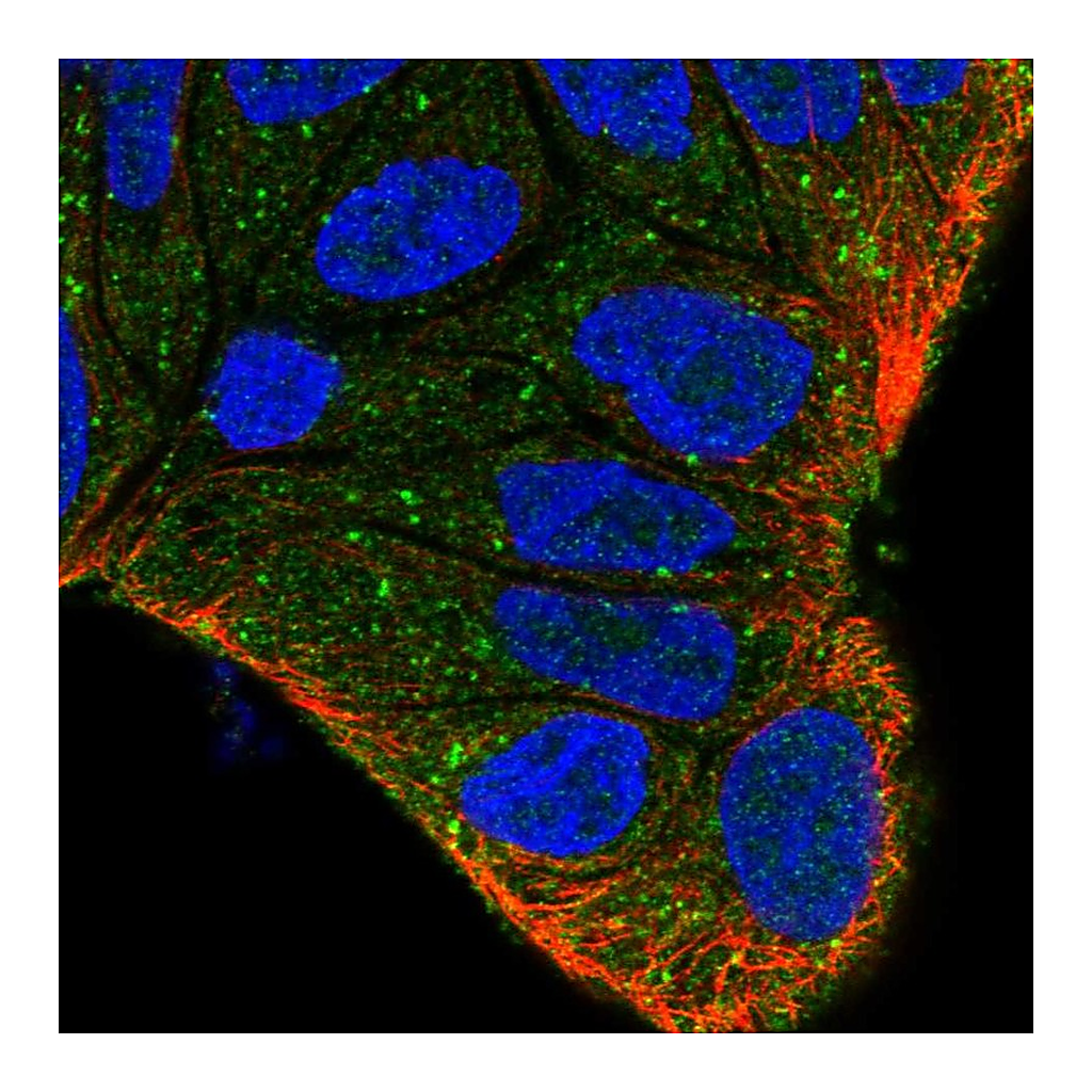 Atlas Antibodies Anti-ZFYVE9 Antibody