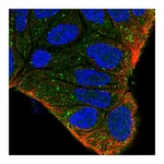 Atlas Antibodies Anti-ZFYVE9 Antibody