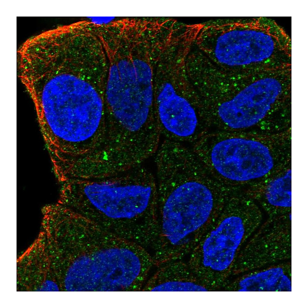 Atlas Antibodies Anti-ZFYVE9 Antibody
