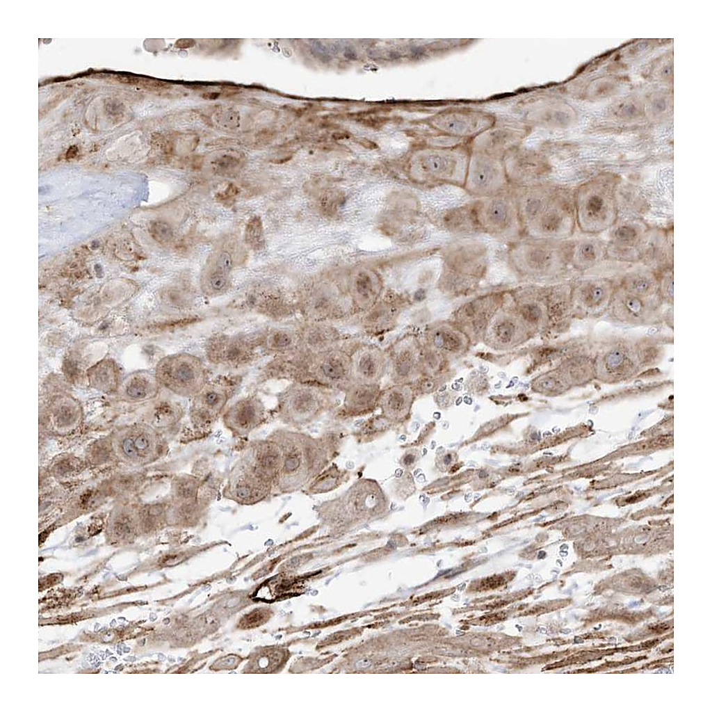 Atlas Antibodies Anti-ZGRF1 Antibody