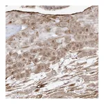 Atlas Antibodies Anti-ZGRF1 Antibody