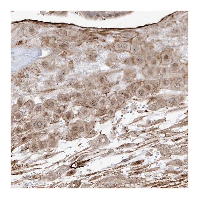 Atlas Antibodies Anti-ZGRF1 Antibody
