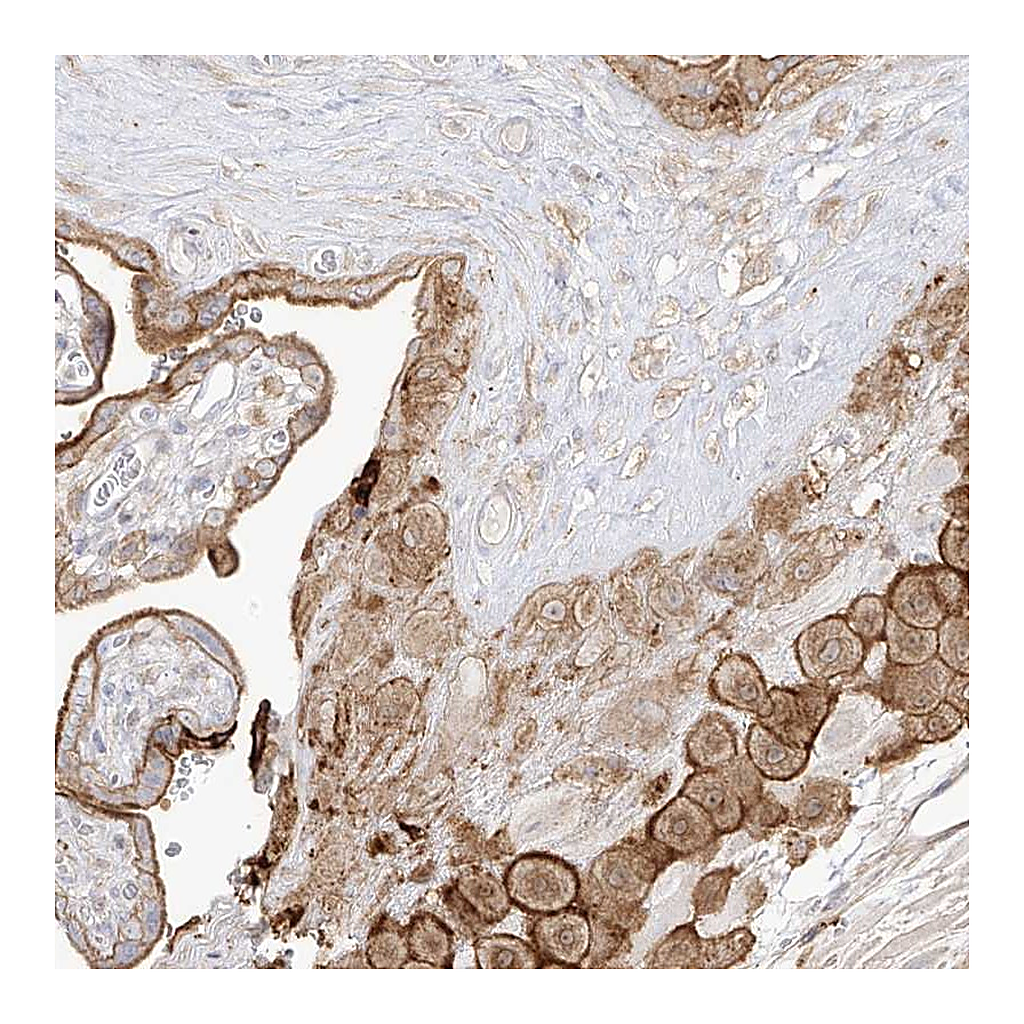 Atlas Antibodies Anti-ZGRF1 Antibody