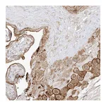 Atlas Antibodies Anti-ZGRF1 Antibody