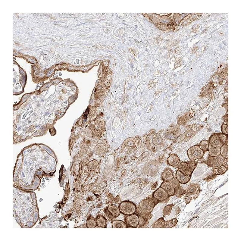 Atlas Antibodies Anti-ZGRF1 Antibody