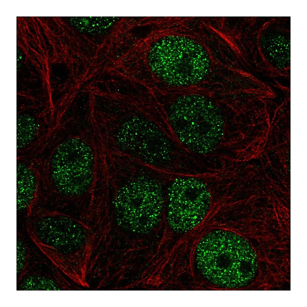 Atlas Antibodies Anti-ZHX1 Antibody