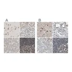Atlas Antibodies Anti-ZHX2 Antibody