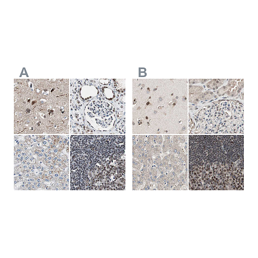 Atlas Antibodies Anti-ZHX2 Antibody