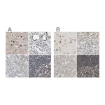 Atlas Antibodies Anti-ZHX2 Antibody