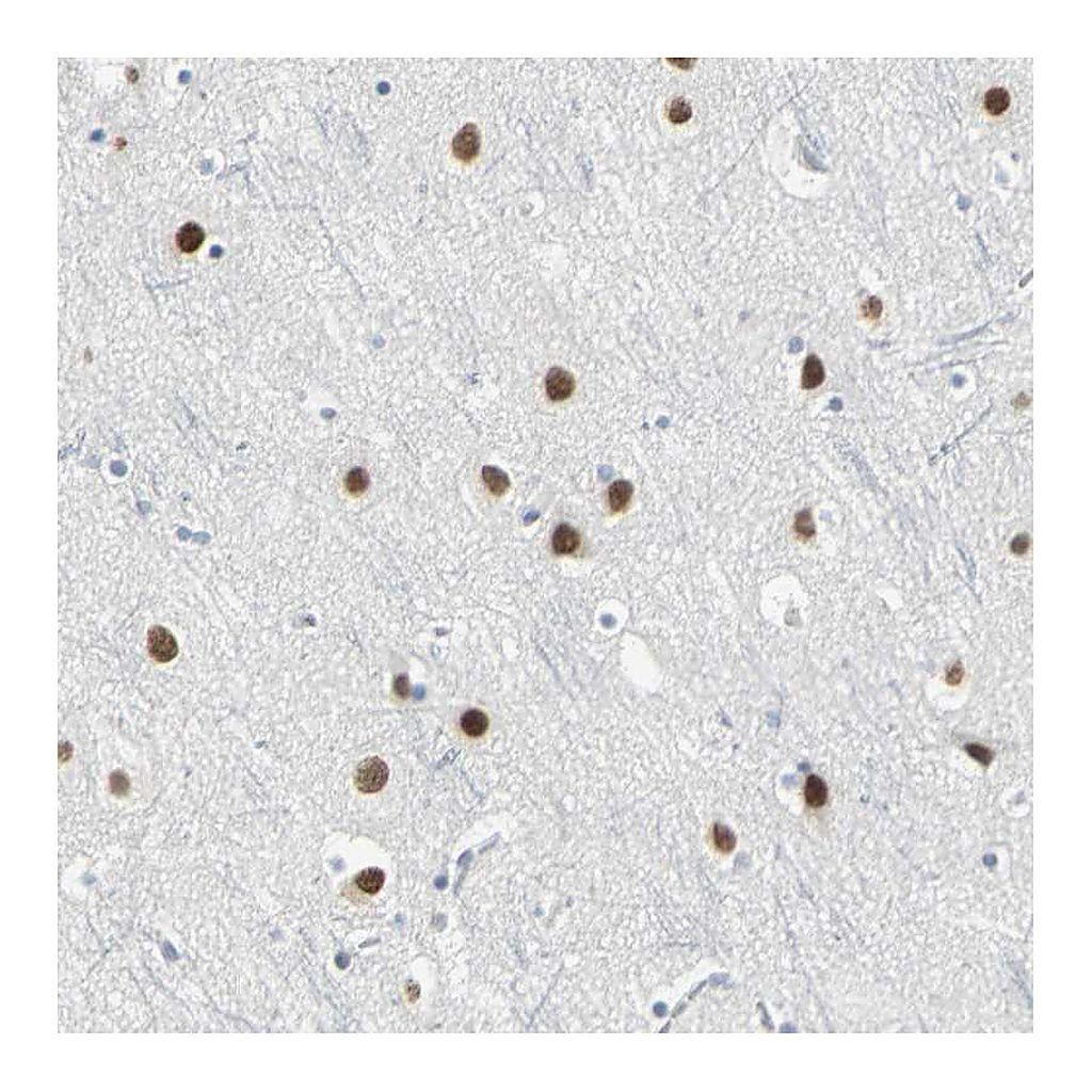 Atlas Antibodies Anti-ZIC1 Antibody