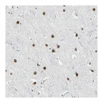 Atlas Antibodies Anti-ZIC1 Antibody