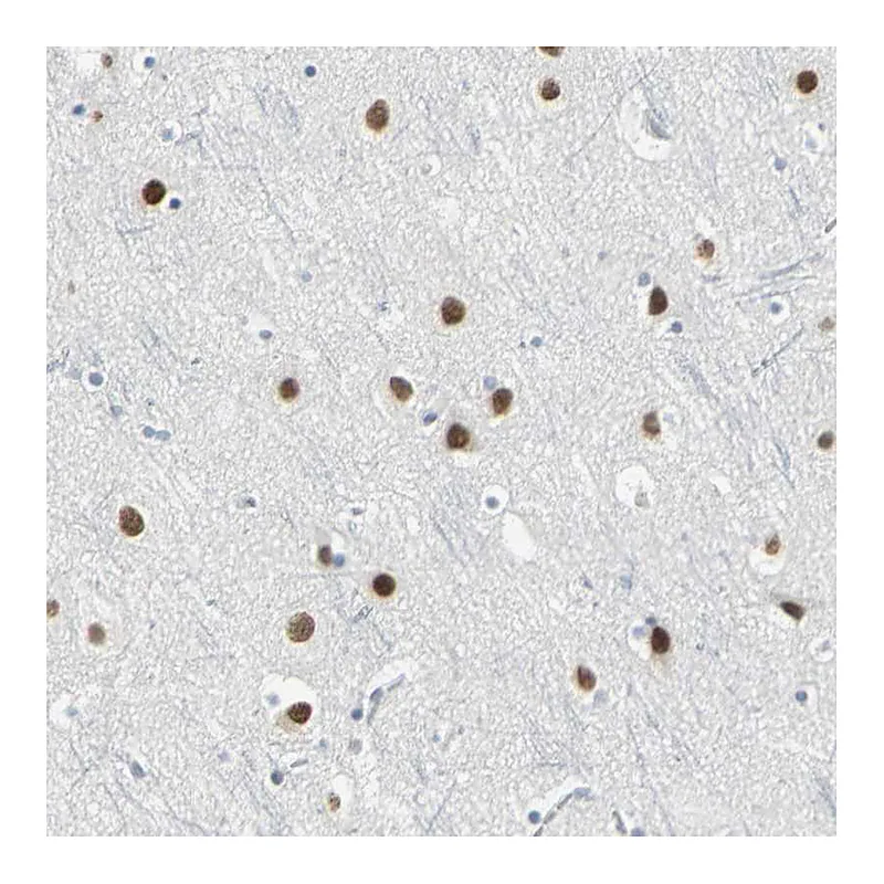 Atlas Antibodies Anti-ZIC1 Antibody