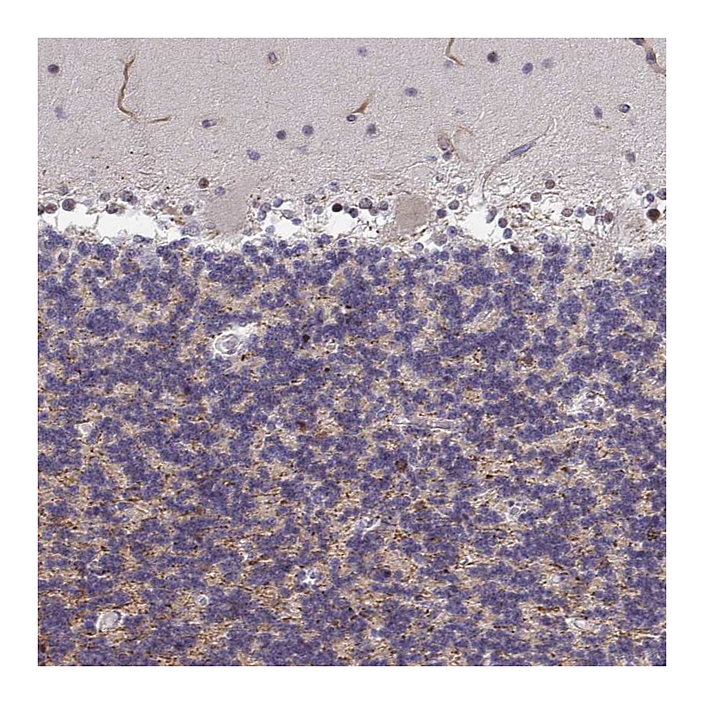 Atlas Antibodies Anti-ZIC3 Antibody