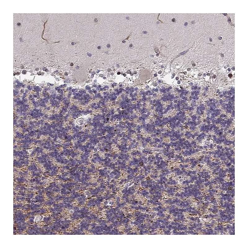 Atlas Antibodies Anti-ZIC3 Antibody