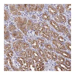 Atlas Antibodies Anti-ZIK1 Antibody