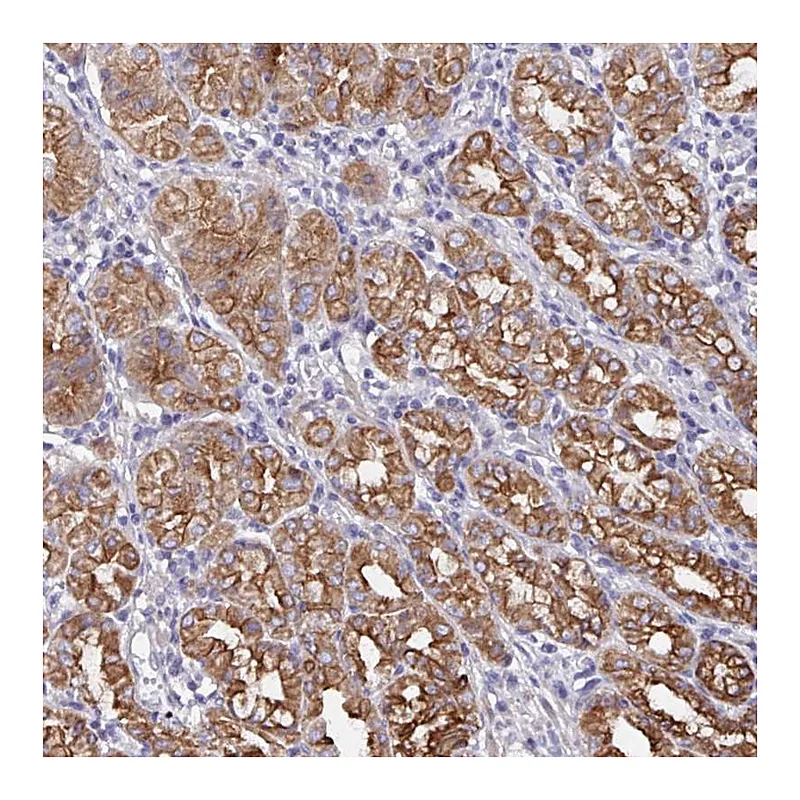 Atlas Antibodies Anti-ZIK1 Antibody