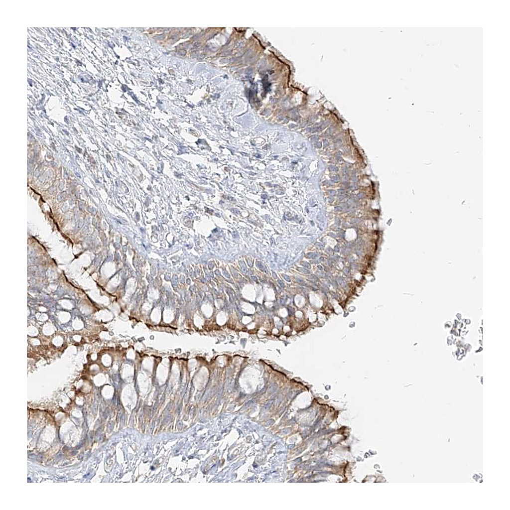 Atlas Antibodies Anti-ZIM3 Antibody