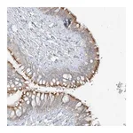 Atlas Antibodies Anti-ZIM3 Antibody