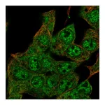 Atlas Antibodies Anti-ZIM2 Antibody