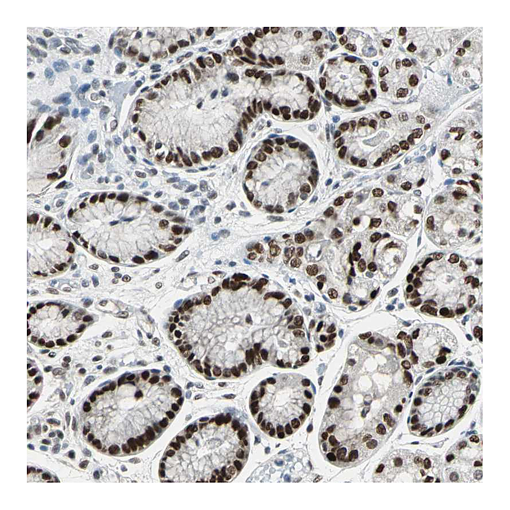Atlas Antibodies Anti-ZKSCAN1 Antibody