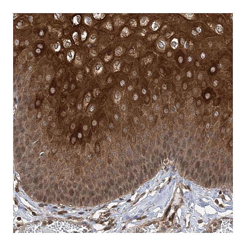 Atlas Antibodies Anti-ZKSCAN5 Antibody