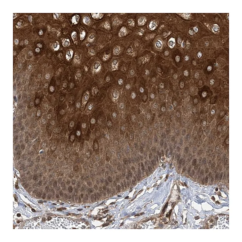Atlas Antibodies Anti-ZKSCAN5 Antibody