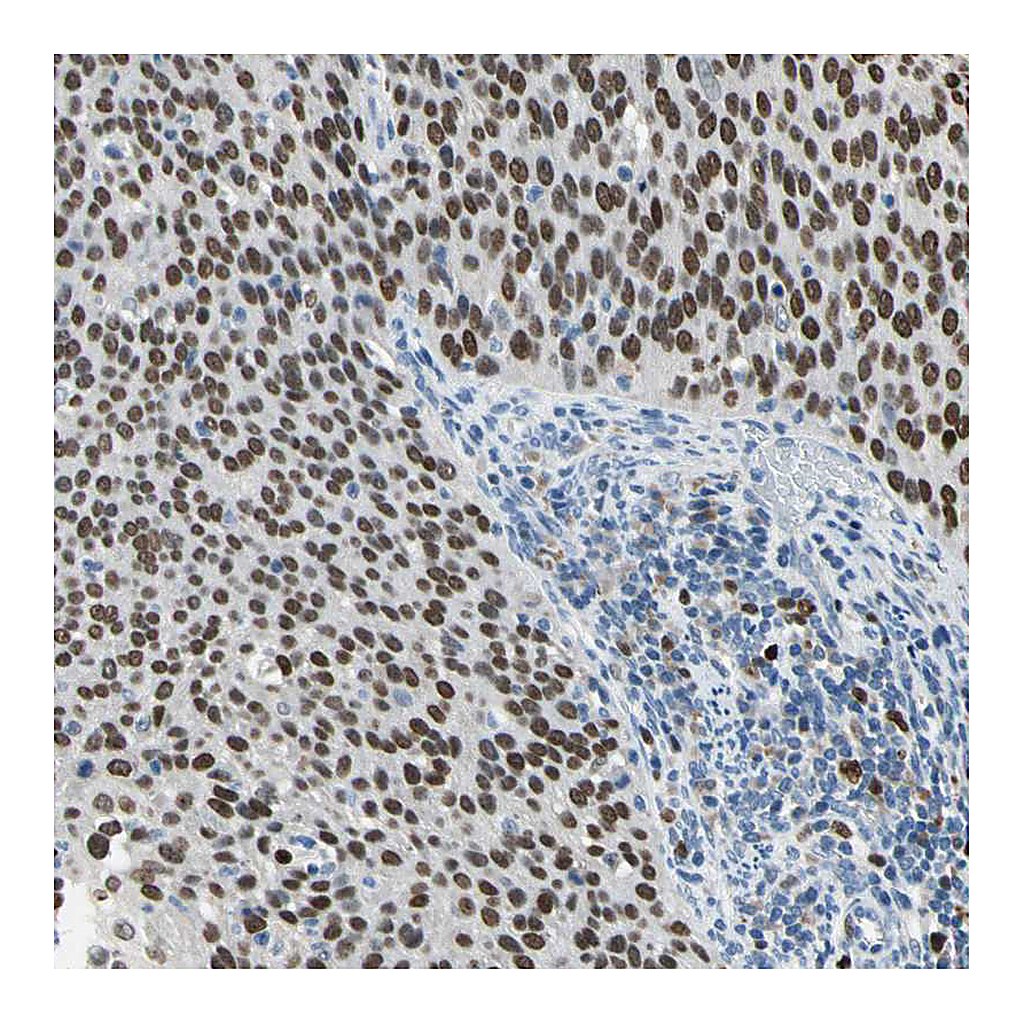 Atlas Antibodies Anti-ZKSCAN3 Antibody