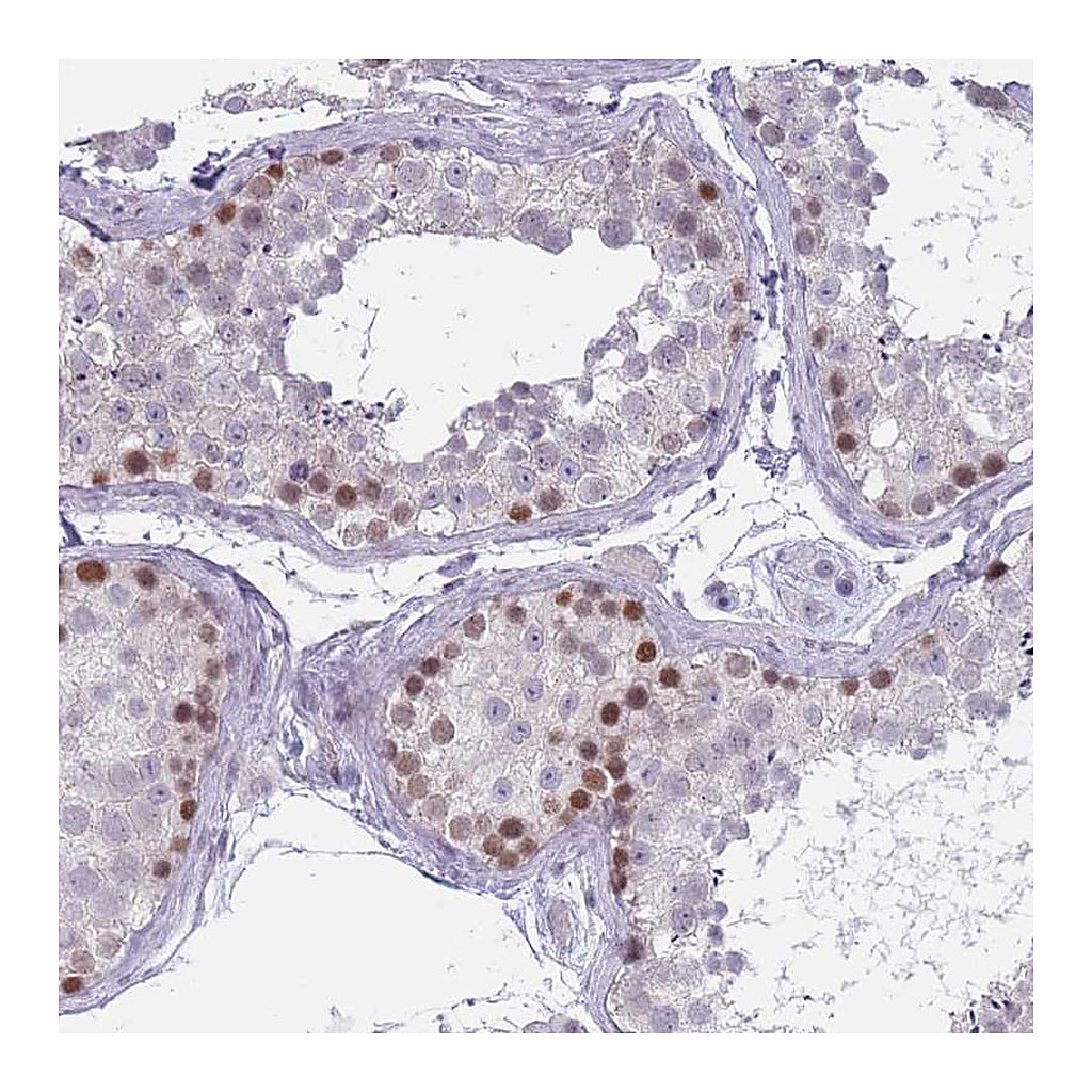 Atlas Antibodies Anti-ZKSCAN2 Antibody