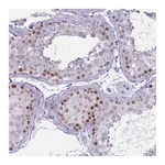 Atlas Antibodies Anti-ZKSCAN2 Antibody