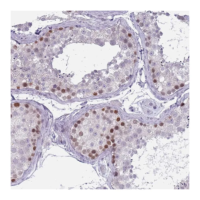 Atlas Antibodies Anti-ZKSCAN2 Antibody