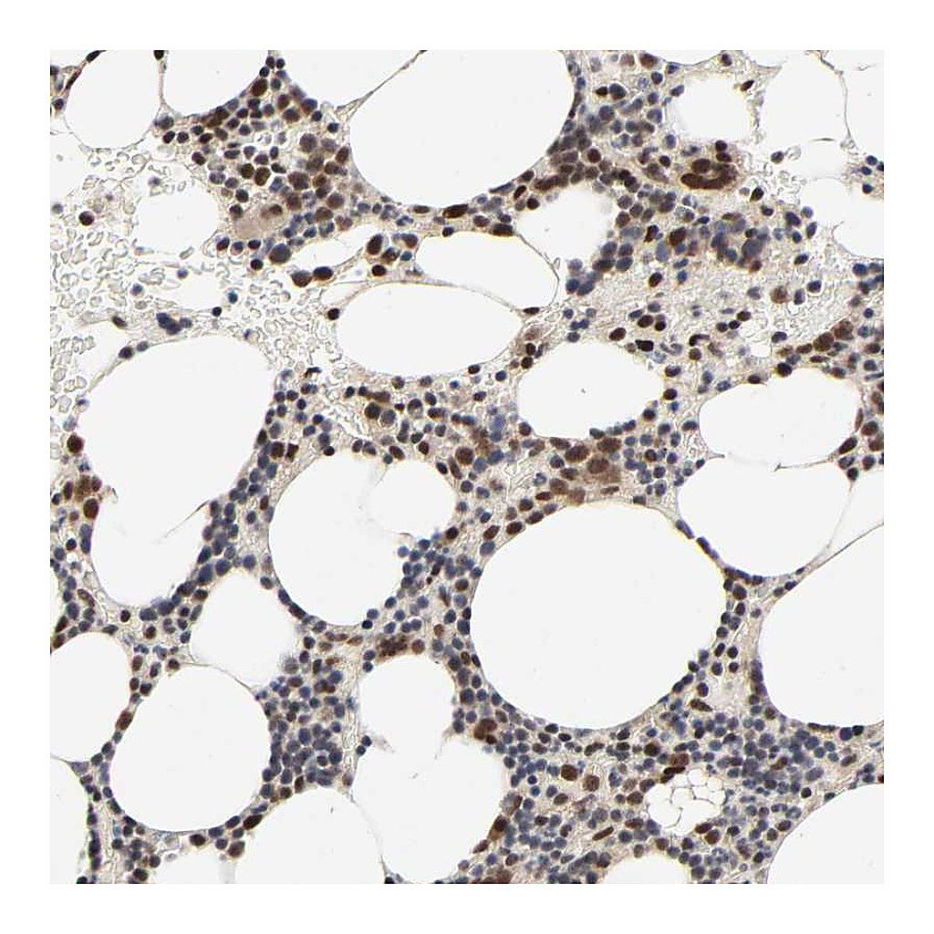 Atlas Antibodies Anti-ZKSCAN8 Antibody