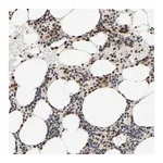Atlas Antibodies Anti-ZKSCAN8 Antibody