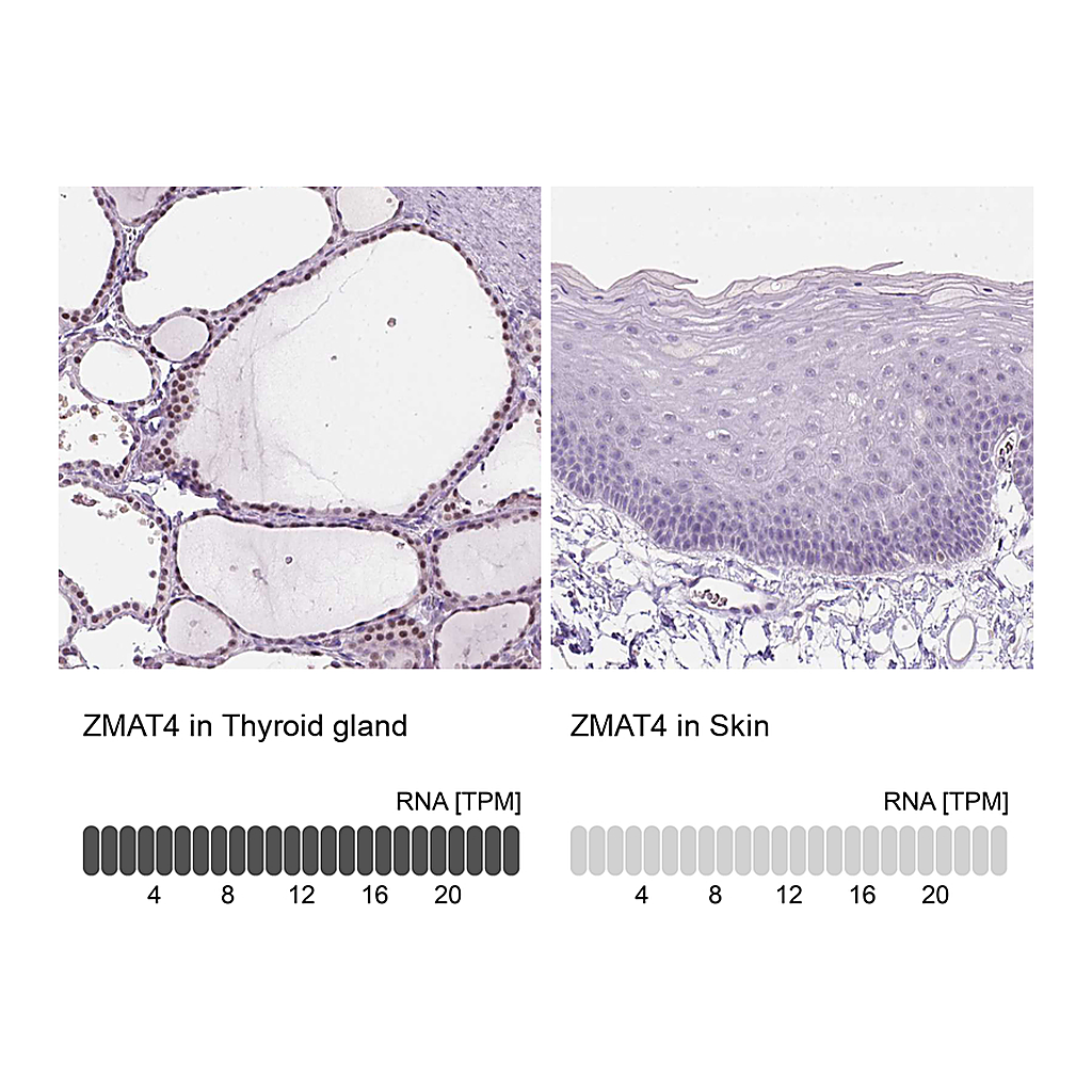 Atlas Antibodies Anti-ZMAT4 Antibody