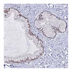 Atlas Antibodies Anti-ZMIZ1 Antibody