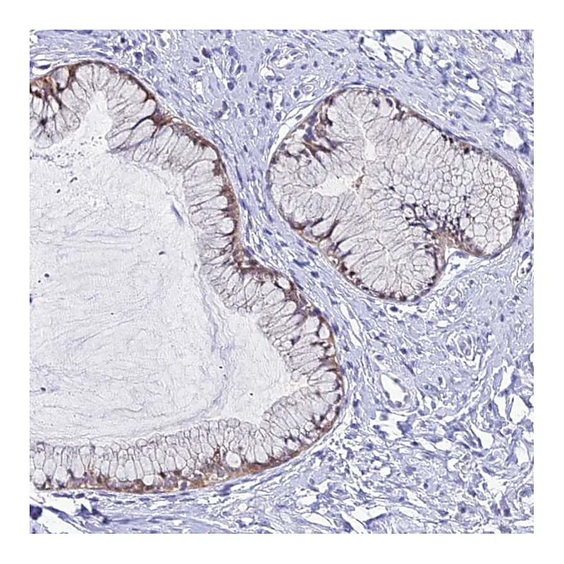 Atlas Antibodies Anti-ZMIZ1 Antibody